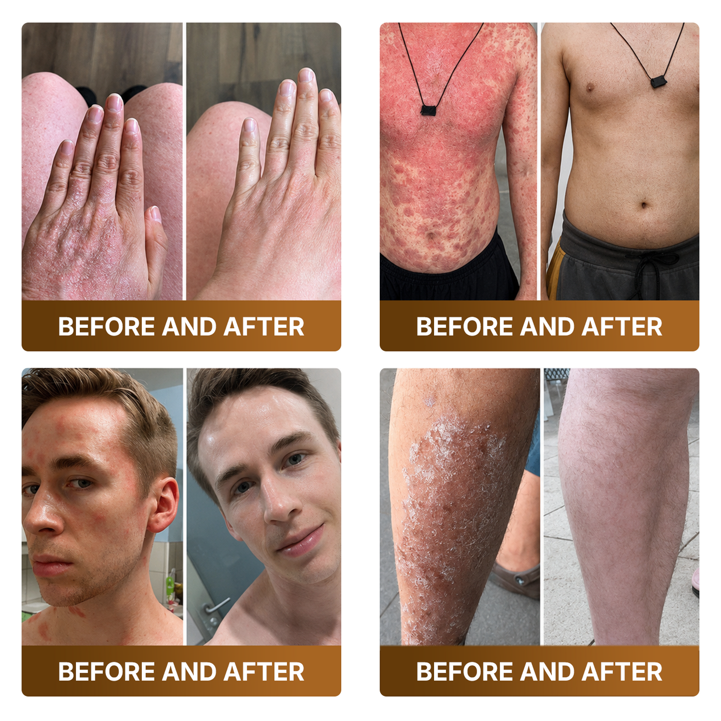 👑Made and Shipped from UK ✨🔥 DOCTIA® Botox & Bee Venom Advanced Recovery Cream—For Wrinkles, Sagging Skin, Skin Tags & Rough Bumps