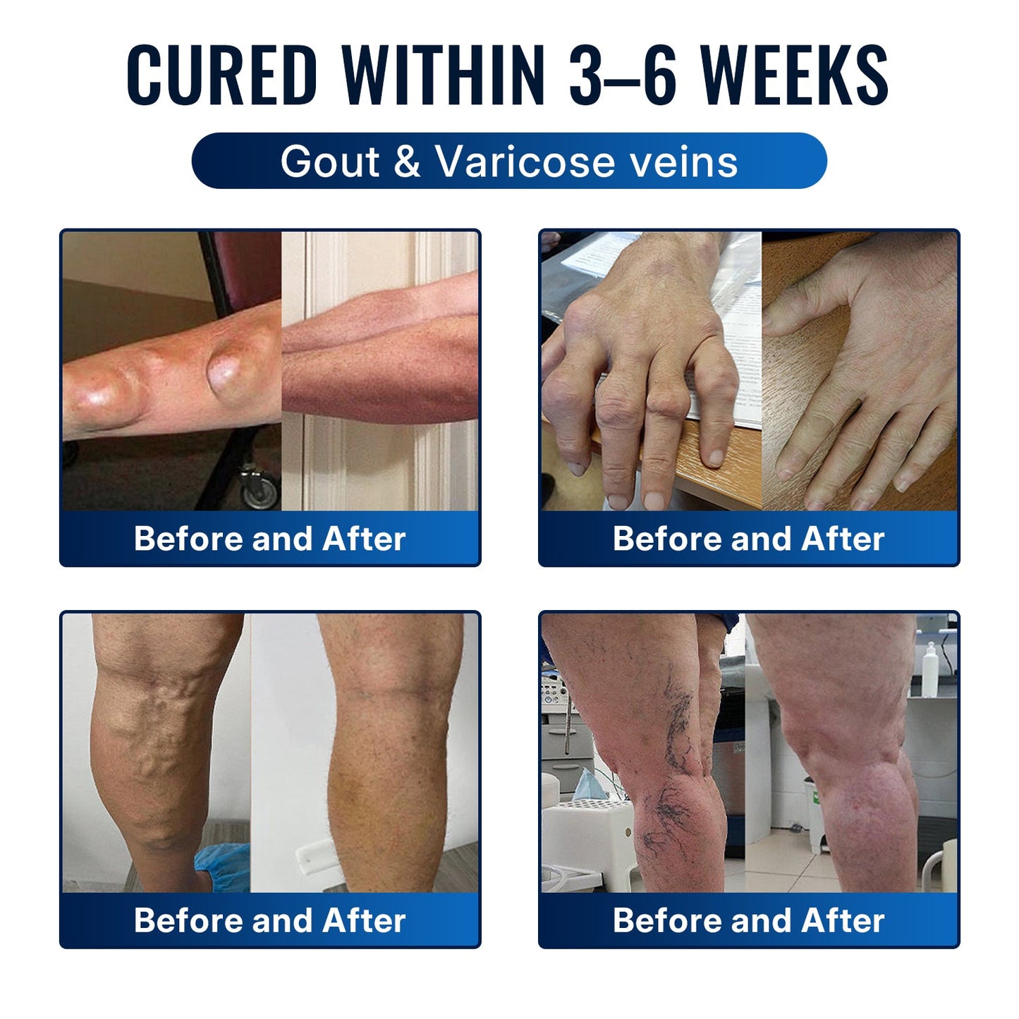 🎁Healrize® Bee Venom Joint Relief Cream 💞Fast-Acting Comfort for Stiff Knees, Hands, Back & Everyday Joint Discomfort.