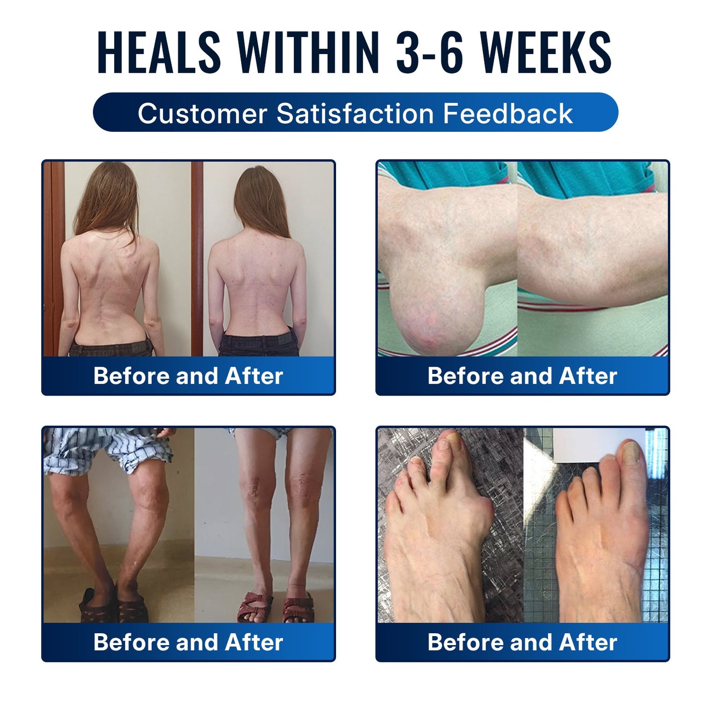 🎁Healrize® Bee Venom Joint Relief Cream 💞Fast-Acting Comfort for Stiff Knees, Hands, Back & Everyday Joint Discomfort.