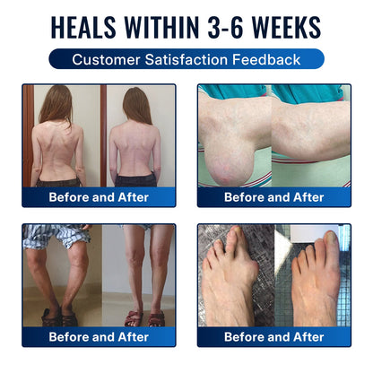 🎁Healrize® Bee Venom Joint Relief Cream 💞Fast-Acting Comfort for Stiff Knees, Hands, Back & Everyday Joint Discomfort.
