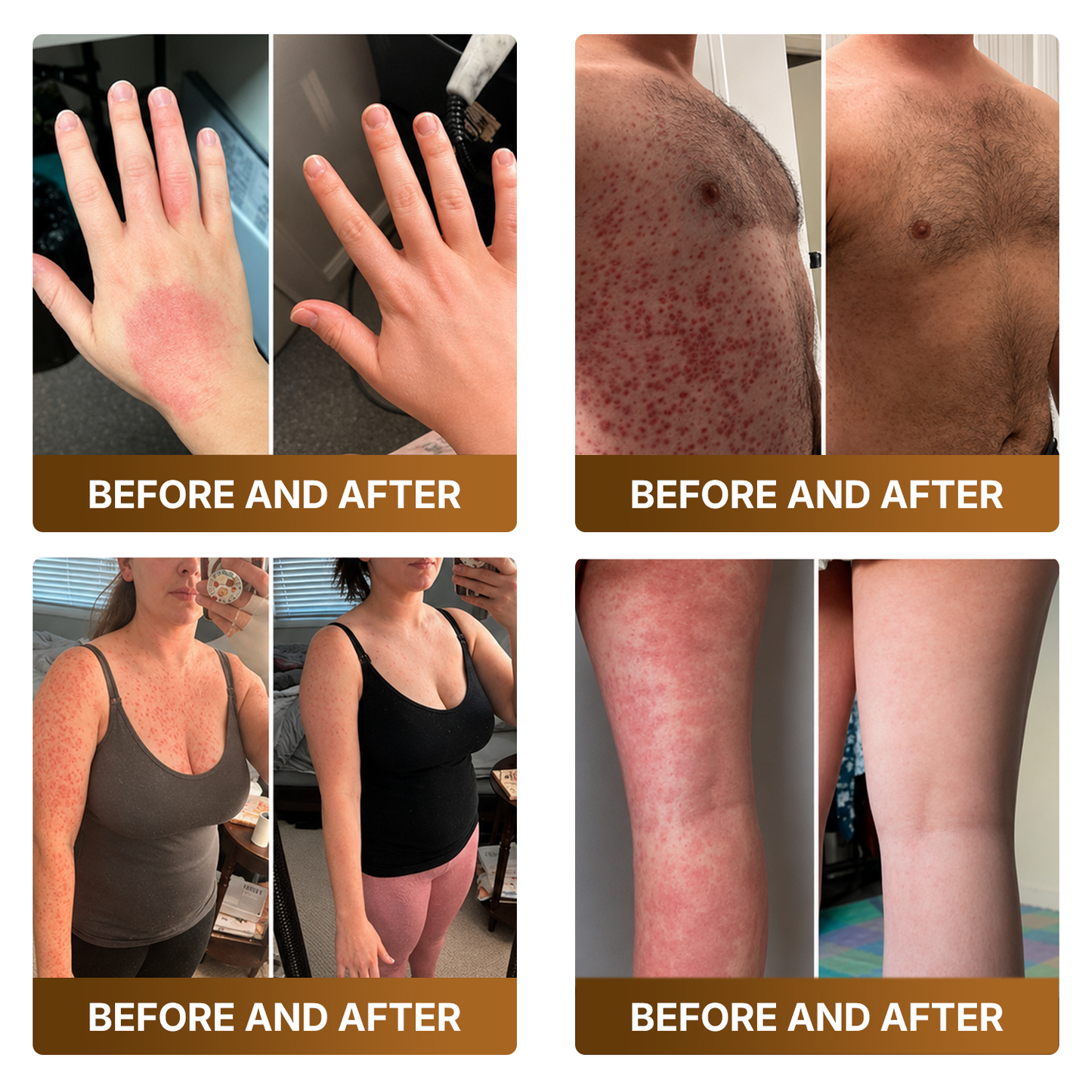 👑Made and Shipped from UK ✨🔥 DOCTIA® Botox & Bee Venom Advanced Recovery Cream—For Wrinkles, Sagging Skin, Skin Tags & Rough Bumps