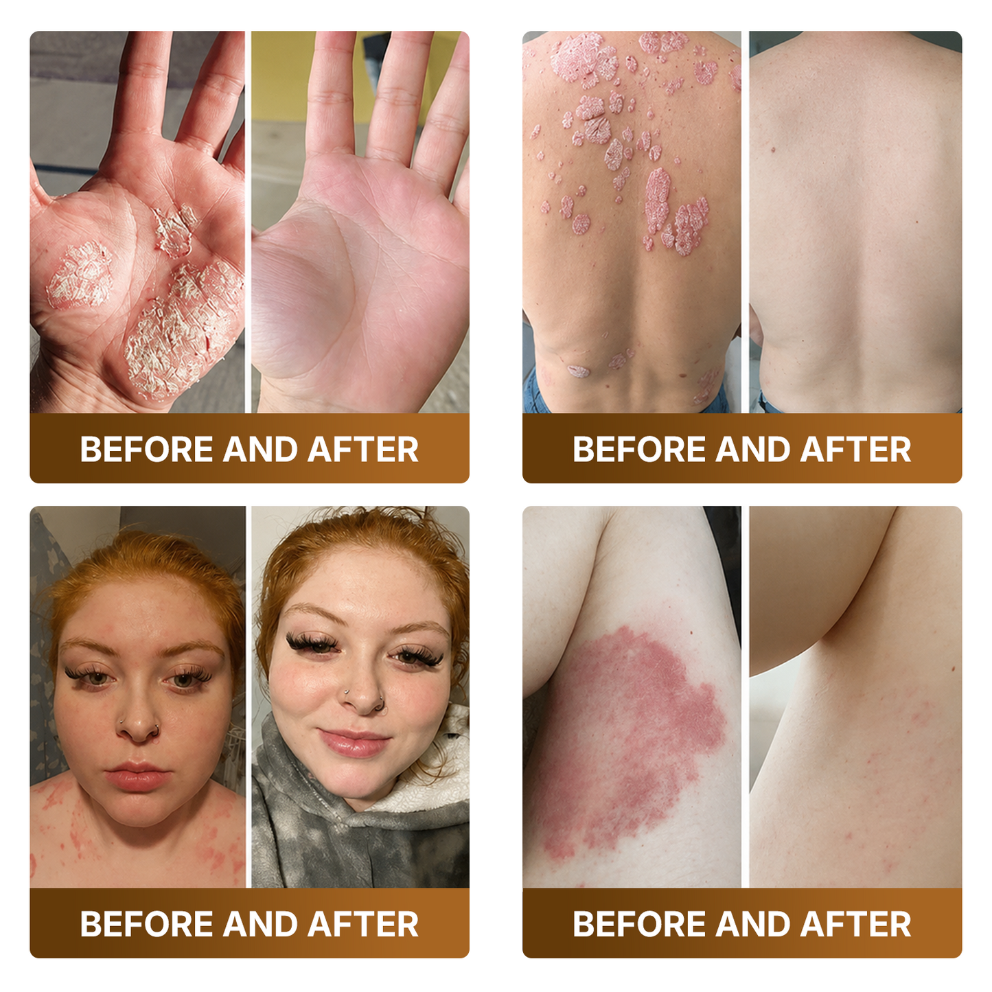 👑Made and Shipped from UK ✨🔥 DOCTIA® Botox & Bee Venom Advanced Recovery Cream—For Wrinkles, Sagging Skin, Skin Tags & Rough Bumps